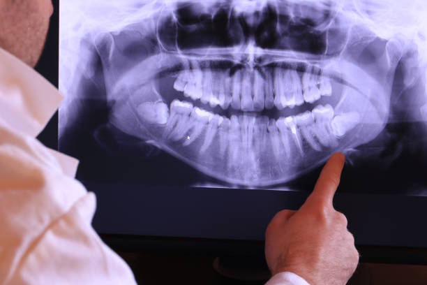 Best Knocked-Out Tooth Emergency  in South Hempstead, NY