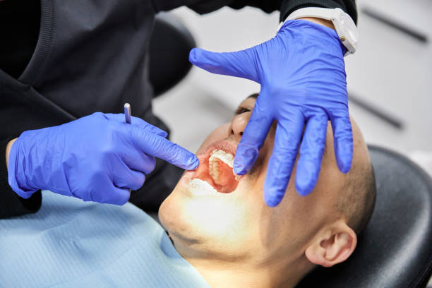 Best Chipped Tooth Repair Near Me  in South Hempstead, NY